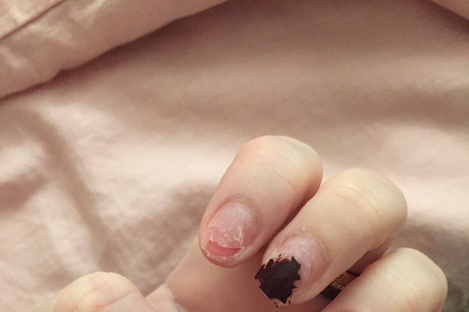 Peligros reales de uñas esculpidas  Mi opinión  Merylar Nails  Beauty